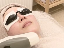 エスツリービューティーアンドネイル(S-TREE BEAUTY&NAIL)/骨格別手技＋光IPL/RFトーニング