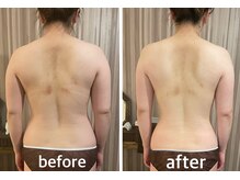 リムアール(Limh R)/