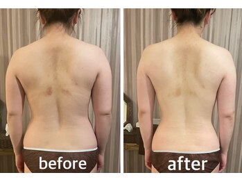 リムアール(Limh R)/