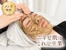 【メンズ専用】初めてのニキビケアにも☆剥離なしハーブピーリング ￥18000→