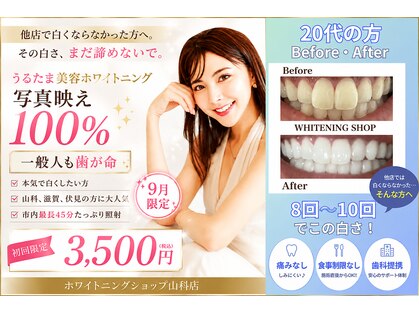 ホワイトニングショップ 山科店の写真
