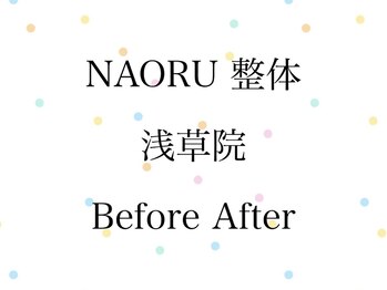 ナオル整体 浅草院(NAORU整体)/NAORU整体 浅草 Before After