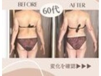 アーユルヴェーダアンドアロマエステ アユス(AYUS)/シロダーラ施術前後