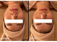 アルテ(ART-e)/Before/Afterプレ花嫁様体験