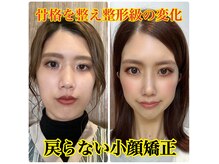 フランツ(glans.)
