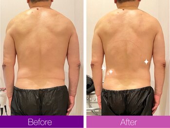 クレヴィア バイ サイバーエステ(CREBIA)/【お腹周り集中】全身120分