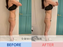 エル 麻布十番(LllL)の雰囲気（痩身[インディバ/インディバ痩身/最新インディバ/ブライダル]）