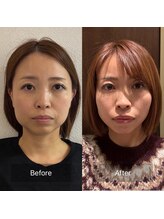 マハロ 海老名店(Mahalo)/小顔矯正