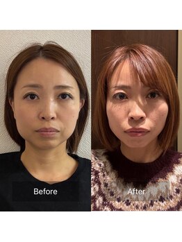 マハロ 海老名店(Mahalo)/小顔矯正