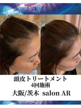メンズサロンアール(AR)/プロセルセラピーズ
