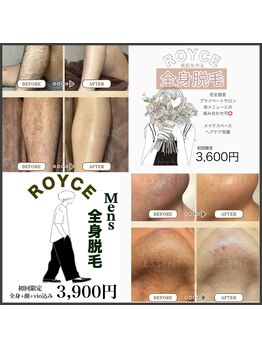 ロイズ(ROYCE)の写真/【都度払い可】初回割引やお得なクーポンをご用意◎全身脱毛で自信が持てるツルスベ素肌へ＊メンズ脱毛も可
