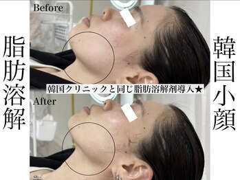 エステティック リベル キョウト 京都駅前店(Esthetic Liber Kyoto)/韓国小顔コルギ×脂肪分解