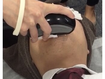 アリガトウ サロン シンパシー(A.Salon Sympathy)/大人気ひげ脱毛