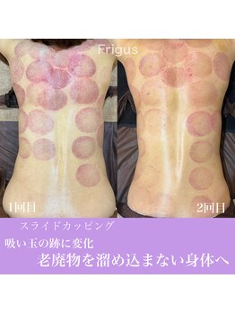 フリグス(Frigus)/【スライドカッピング】