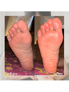 バリスパアラミー(balispa Alami)/更年期・生理不調・冷え