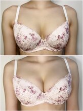 ふわふわのマシュマロバスト