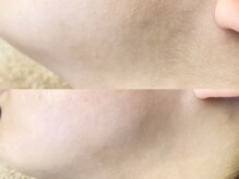 アイブロウドット 大宮(iBROW.)/お顔まわりワックス脱毛