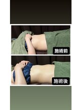 サロン シャンティー/キャビZERO【ダイエット】