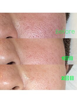 ビューティ サロン ココ ア ドール(Coco a Doll)/韓国肌管理ララピール