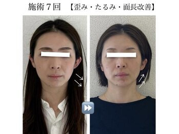 ラボーテヴェリテ(La Beaute Verite)/【お客様施術例】