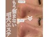 【学割U２４】新生活応援ハイドラ毛穴洗浄￥9800→￥5000