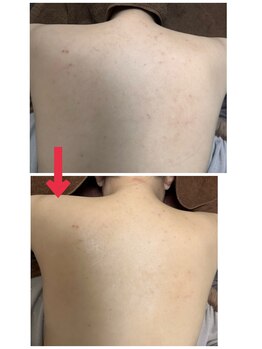 スリリアン 銀座/★お客さまビフォーアフター★