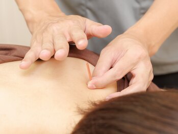 マッサージ鍼灸院つゆき按腹堂/痛みの少ない鍼で