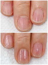 シュガーズネイル(sugar's nail)/自爪育成3ヶ月コース