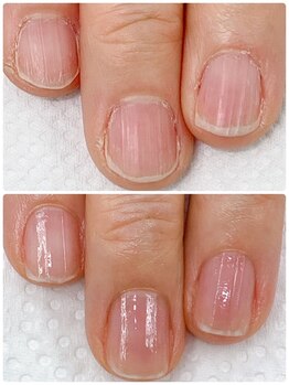 シュガーズネイル(sugar's nail)/自爪育成3ヶ月コース