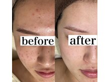 エルア 尼崎(Elua)/