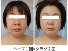 ティアス(t-us)/【肌育×エイジングケア】