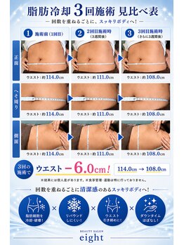 エイト(eight)/脂肪冷却Before → After