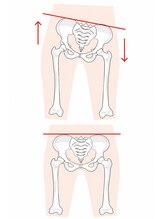ココワ(cocowa)&nbsp;腰痛の 原因