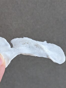 フォルス 天王寺(fors)/フェイスワックス脱毛