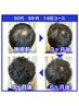 【男女可/育毛促進】髪のハリ、コシでお悩みの方へ！人気上昇中！！