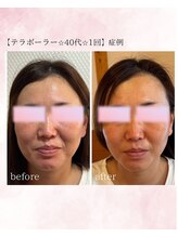 ソワイユ 浜松店(Soyeux)/テラボーラー　before→after