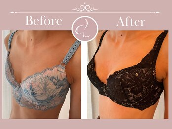 美バストアルファ(美bust α)/【バストアップ