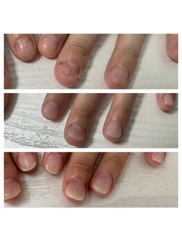 リーフ(Leaf)/長さ形をその場で形成