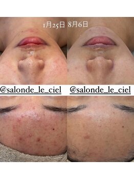 サロンドゥルシェル(salonde_le ciel)/クリスティーナ×ハーブリプロ