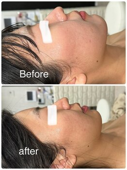 ルミネル 名古屋新栄(Luminelle)/小顔矯正