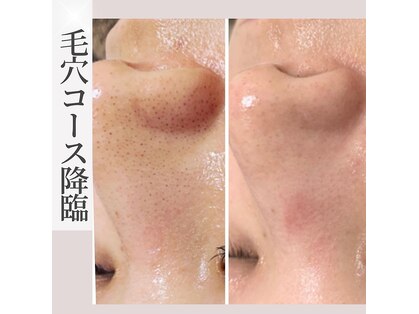 ラ ヴォーテ(La beaute)の写真