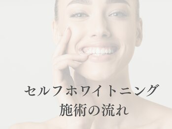 ホワイト 福岡天神店(WHITE)/セルフホワイトニング施術の流れ
