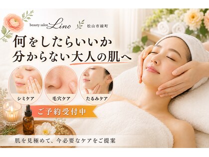 リノ(Lino)の写真