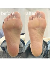 ハンハウス(Hanhouse)/人気のフットケア