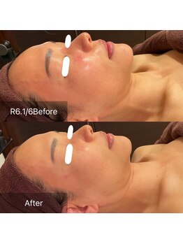 サンベリーナ(Thumbelina)/