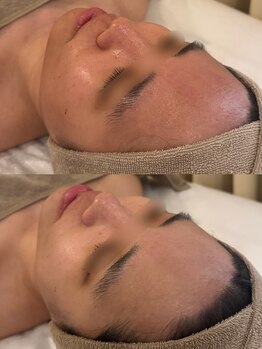 セレニテ(Serenite)/