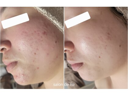 サロンドリー(salon de Re)の写真