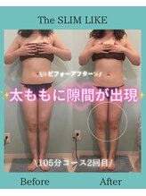 スリムライク 鳥取店(The SLIM LIKE)/痩身ビフォーアフター