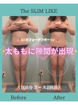 スリムライク 鳥取店(The SLIM LIKE)/痩身ビフォーアフター