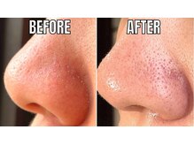 プレジール(Plaisir)の雰囲気（大人気ハイドロフェイシャル＊いちご鼻卒業！＃毛穴ケア）